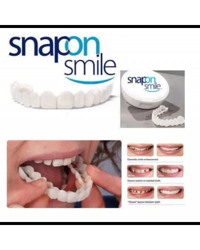 Виниры SnapOn Smile Veneers для зубов снеп он смайл 1 ЧЕЛЮСТЬ